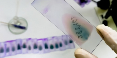 Recommandation Aplasie médullaire de l’enfant 